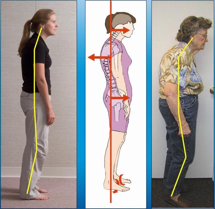 [Image: postural-distortions-and-posture1.jpg]