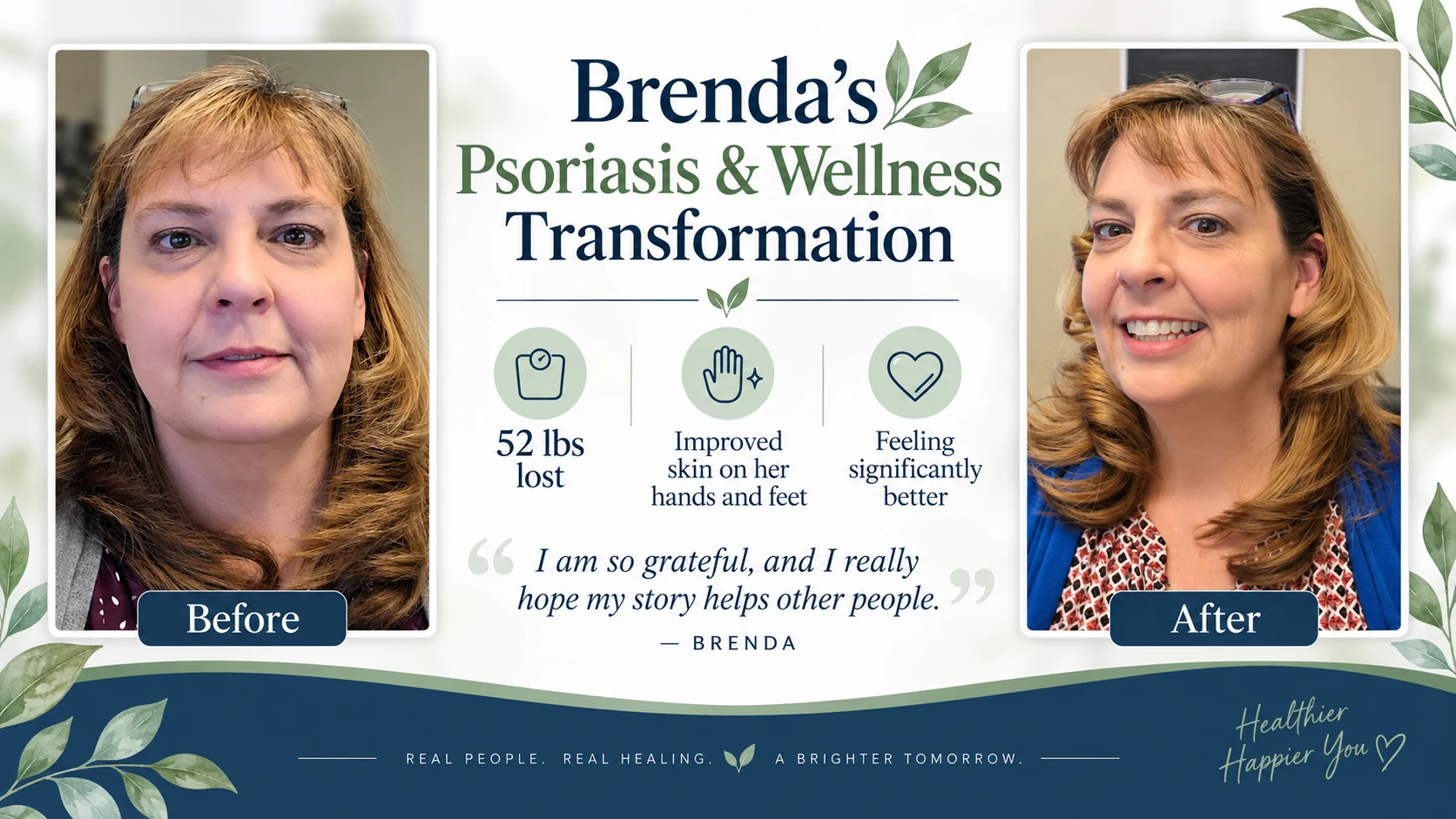 Brenda before and after psoriasis and wellness transformation, including a 52-pound weight loss