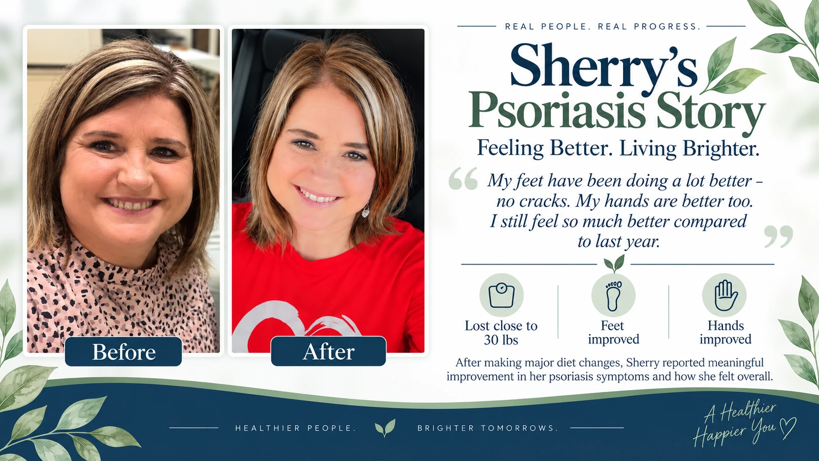 Sherry before and after psoriasis wellness transformation, including close to 30 pounds of weight loss