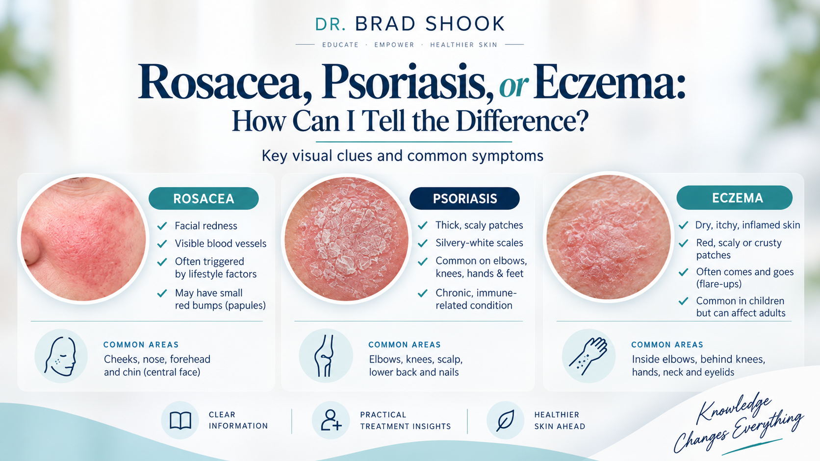 Rosacea, psoriasis or eczema: how can I tell the difference?