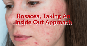 Rosacea and Functional Medicine