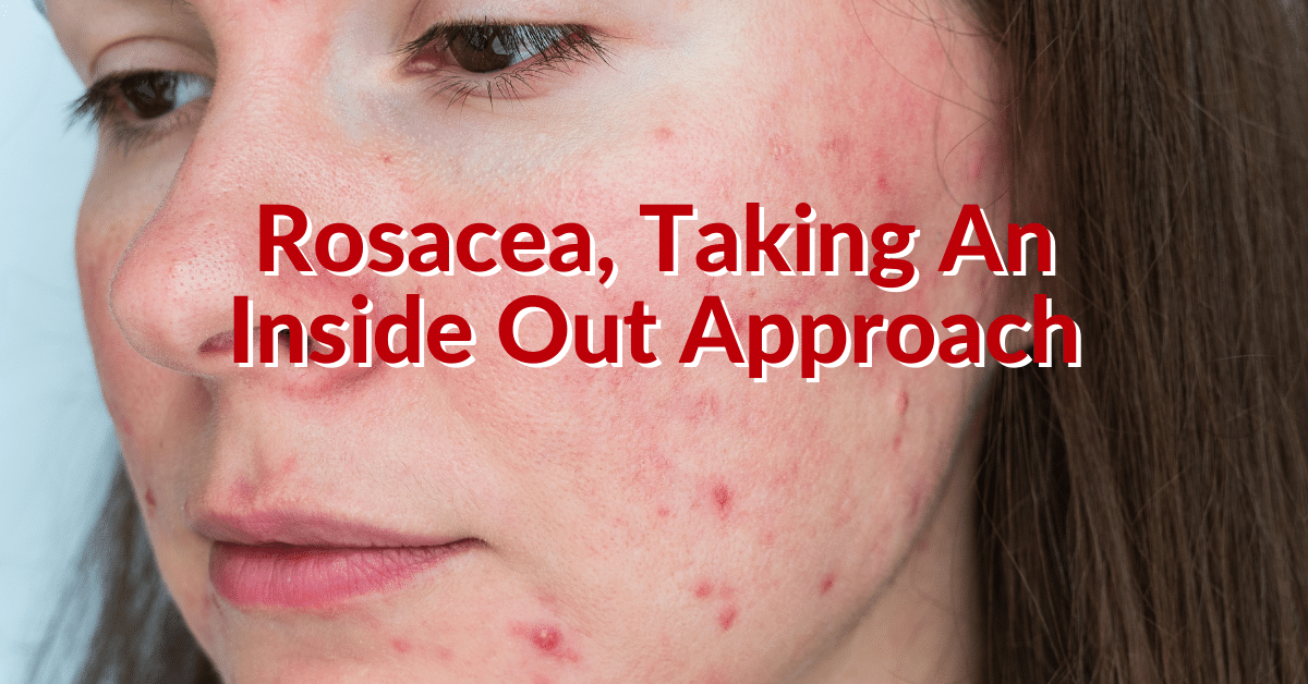 Functional Medicine Rosacea Approach to Healing Rosacea