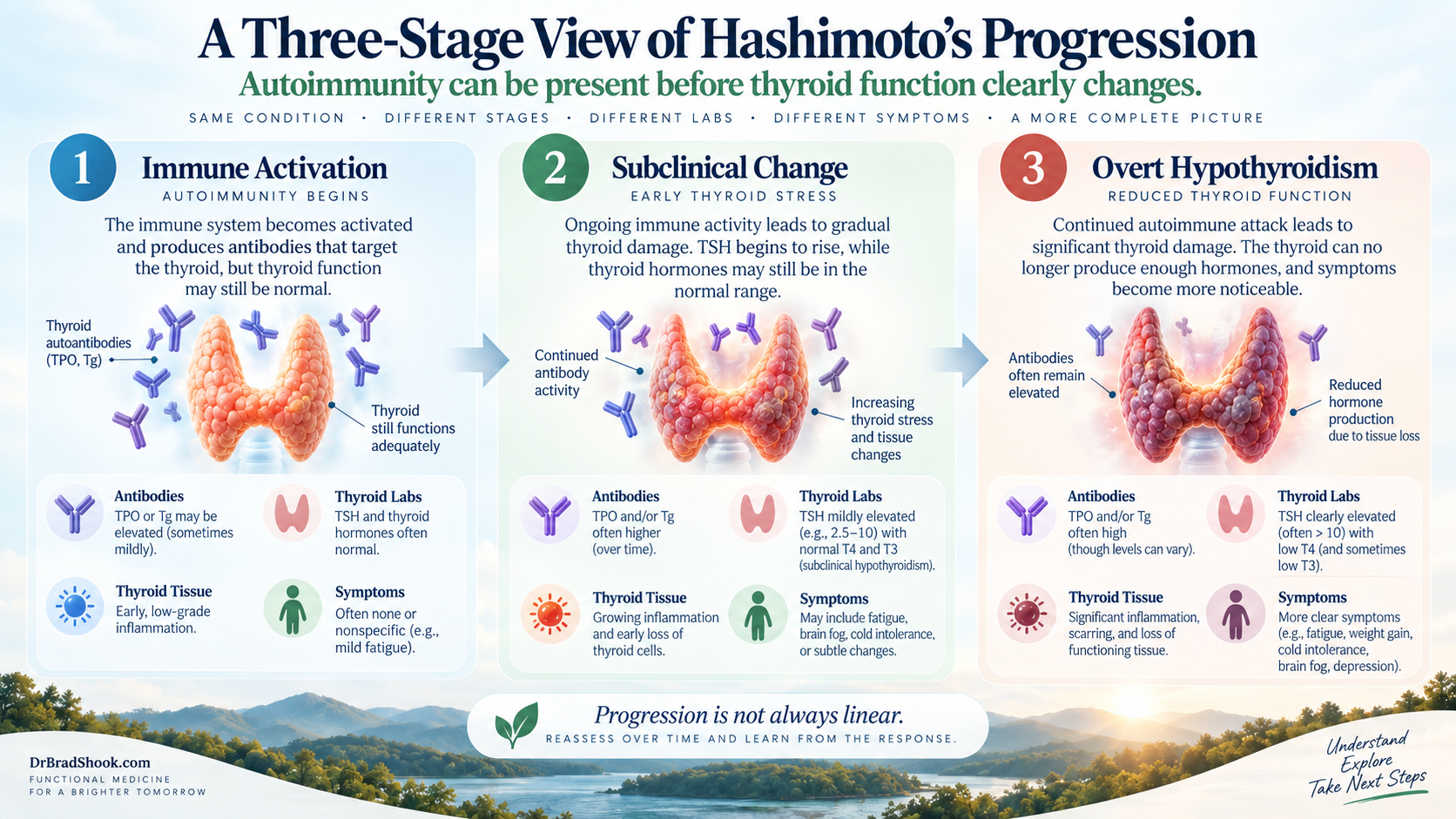 Three stages from thyroid autoimmunity to subclinical and overt hypothyroidism