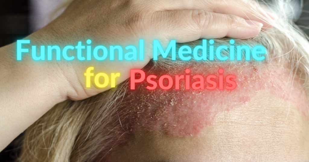 Functional Medicine for Psoriasis Functional Medicine for Psoriasis