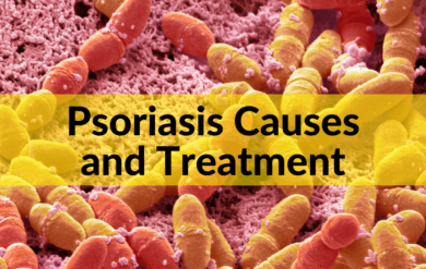Psoriasis Causes and Treatment