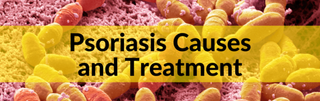 Psoriasis Causes and Treatment