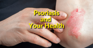 Psoriasis and Your Health