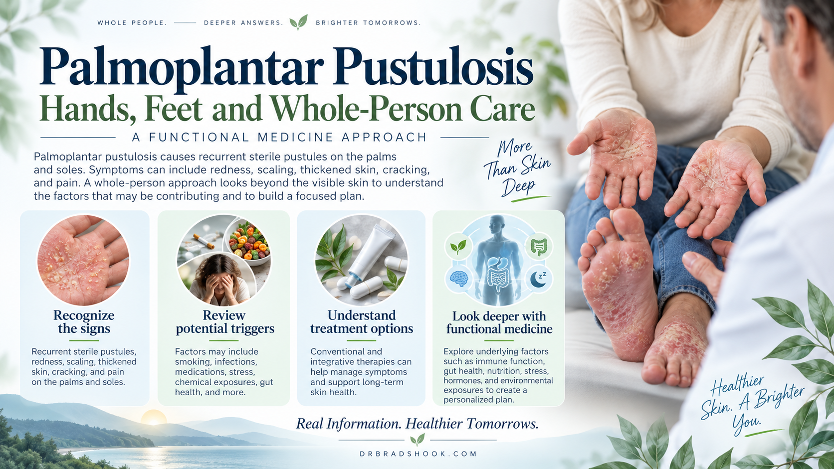 Person discussing palmoplantar pustulosis affecting hands and feet