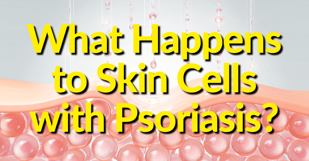 People with psoriasis have skin cell growth. The new skin cells eventually die, leaving dead skin cells and thick inflammed plaques where white blood cells accumulate.