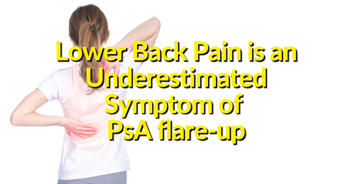 Sometimes those with psoriatic arthritis experience low back pain that could be a condition called spondylitis. 