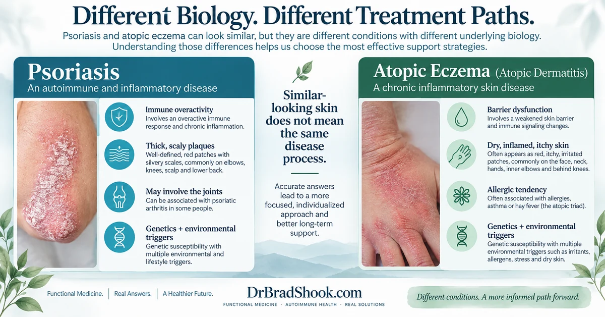 Comparison of psoriasis autoimmune biology with atopic eczema skin barrier and inflammatory biology