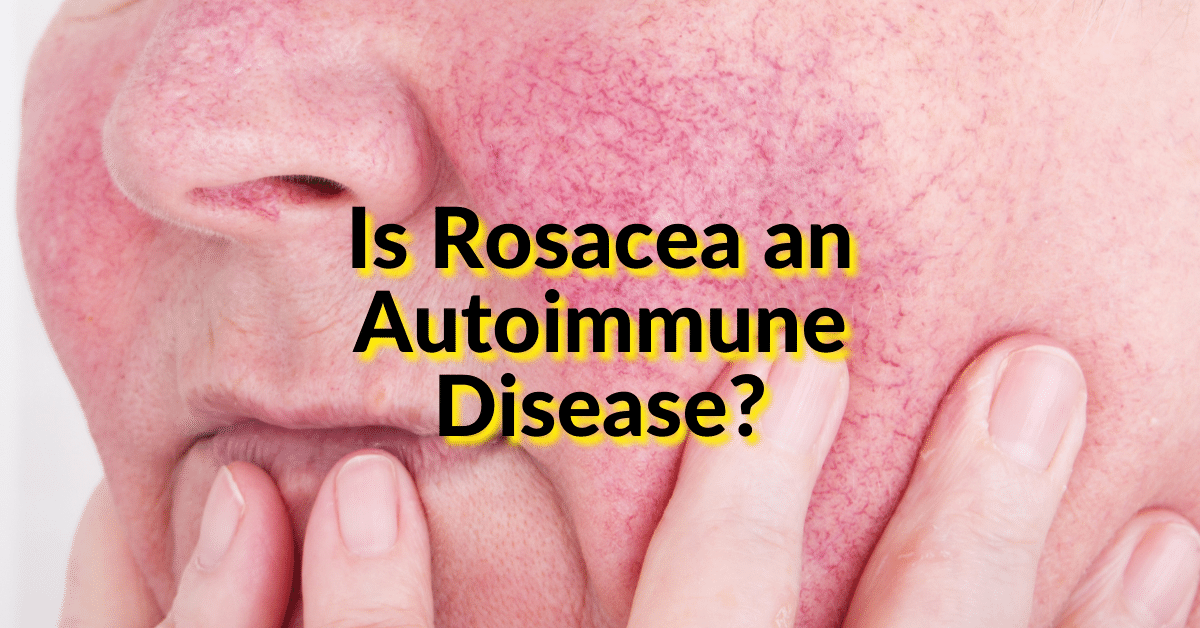 Psoriasis Vs Rosacea Differences Treatment And Other Conditions 1976