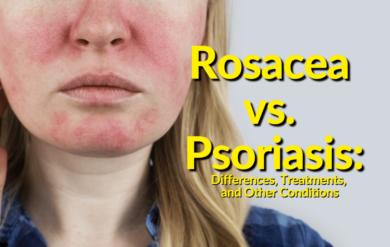 We look in-depth at the differences between psoriasis and rosacea and cover treatment options. In addition, why it is important to use functional medicine.