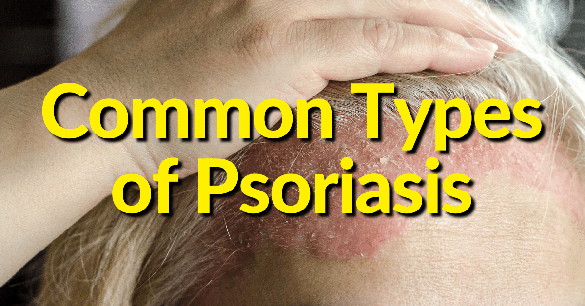 Plaque psoriasis, guttate psoriasis, inverse psoriasis, pustular psoriasis, erythrodermic psoriasis, and scalp psoriasis
