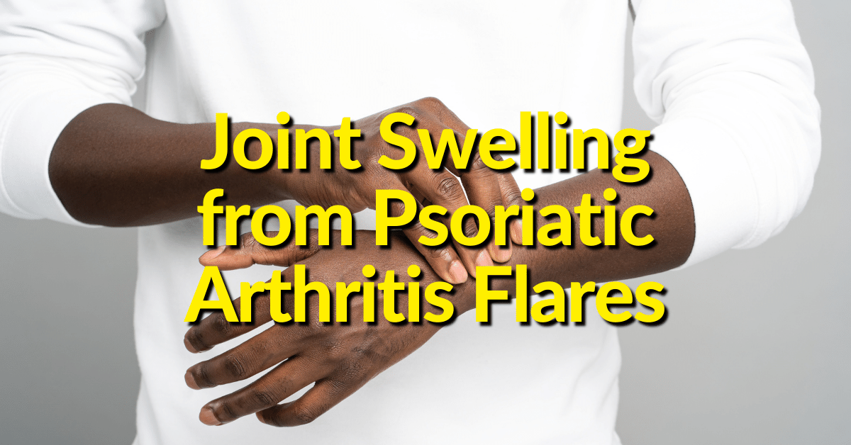 Those who develop psoriasis may begin to experience joint problems such as swelling and pain. 