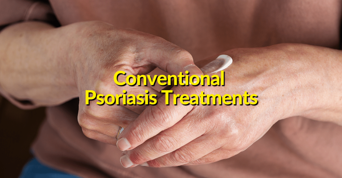 Conventional psoriasis treatment options include light therapy, ointments and medications. 