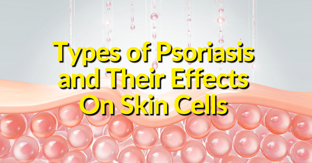 There are different types of psoriasis.  These skin disorders present slightly different on affected skin and in the joints. 