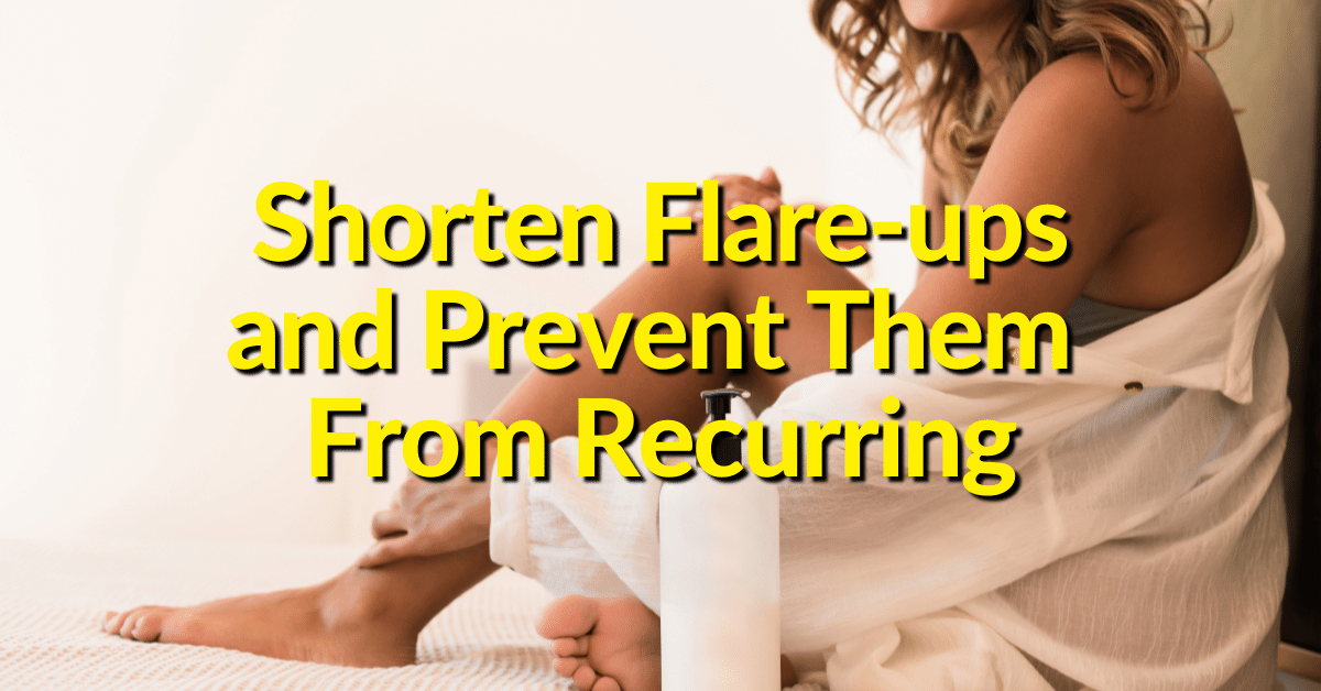 Topical steroid creams and moisturizers can help minimize flare-ups and prevent psoriasis.  Avoid triggers that are known to worsen symptoms. 