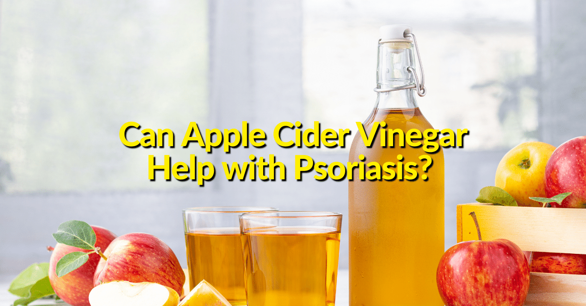 There are many natural and conventional treatment options for psoriasis symptoms--can apple cider vinegar help treat psoriasis as well? 