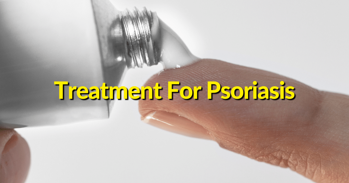 Treat and prevent psoriasis through a variety of topical therapy options, steroid creams, maintaining a healthy weight, using medicated shampoo and living a healthy lifestyle. 