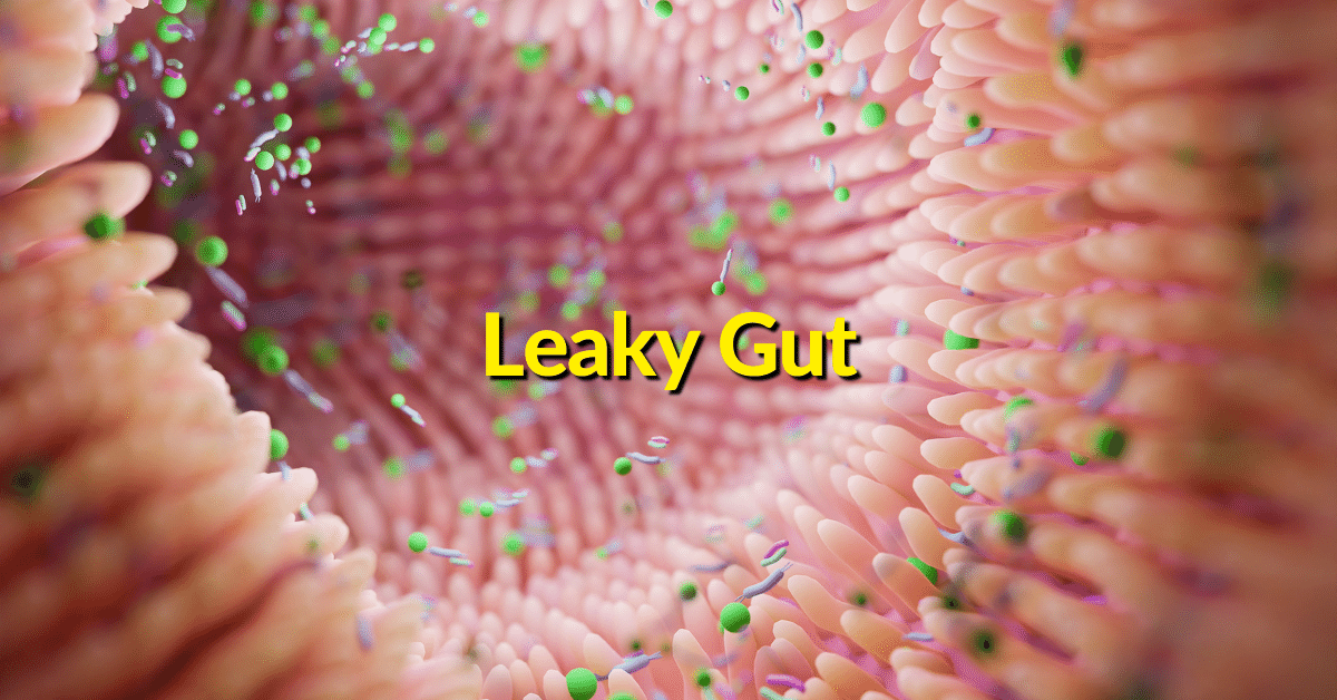 Holistic gut health focuses on healing the leaky gut. Leaky gut issues are linked to many disorders such as chronic constipation, irregular bowel movements, autoimmune disease, IBS symptoms, and skin issues. 