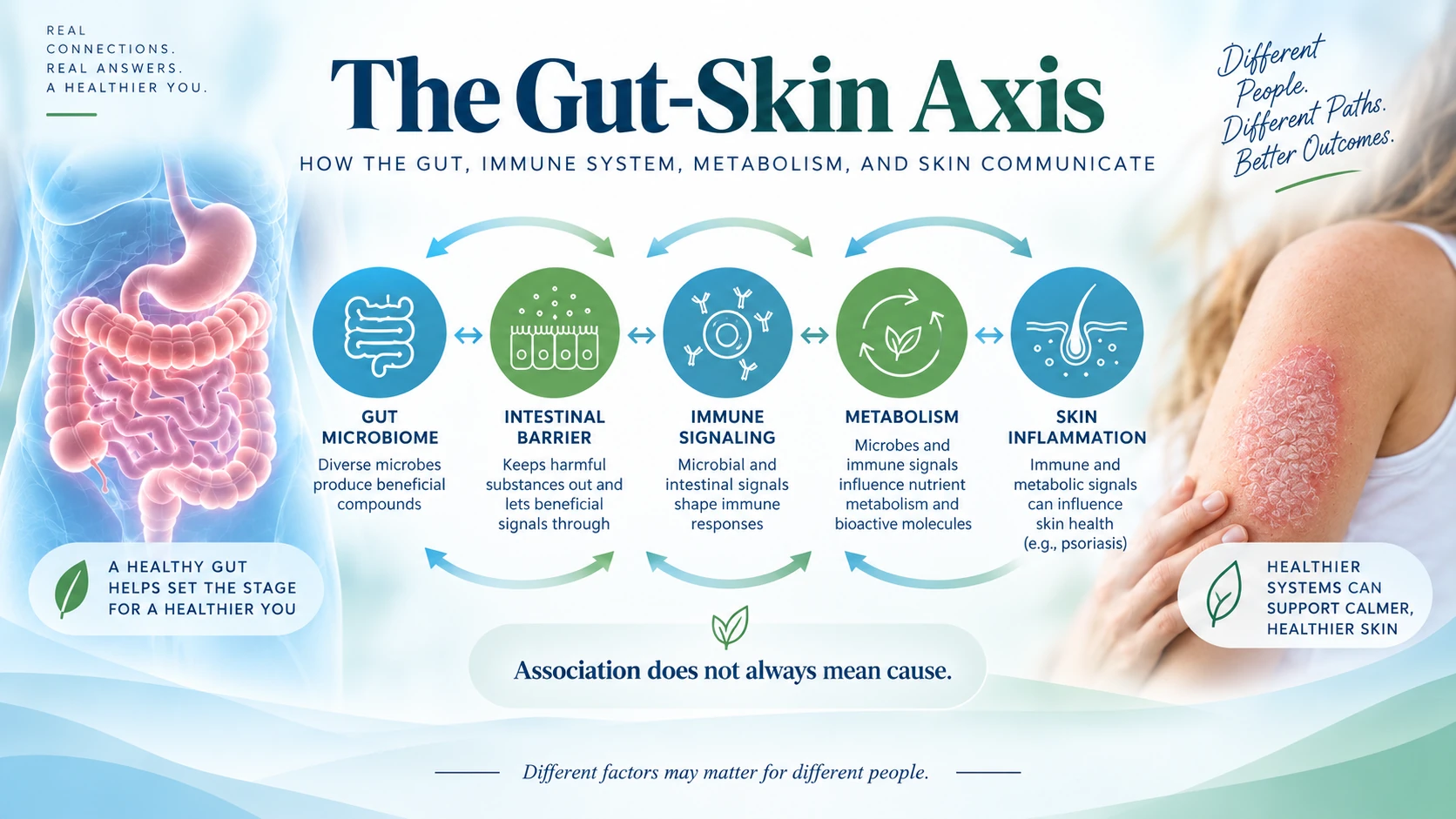 Gut-skin axis in psoriasis showing the gut microbiome, intestinal barrier, immune signaling, metabolism, and skin inflammation