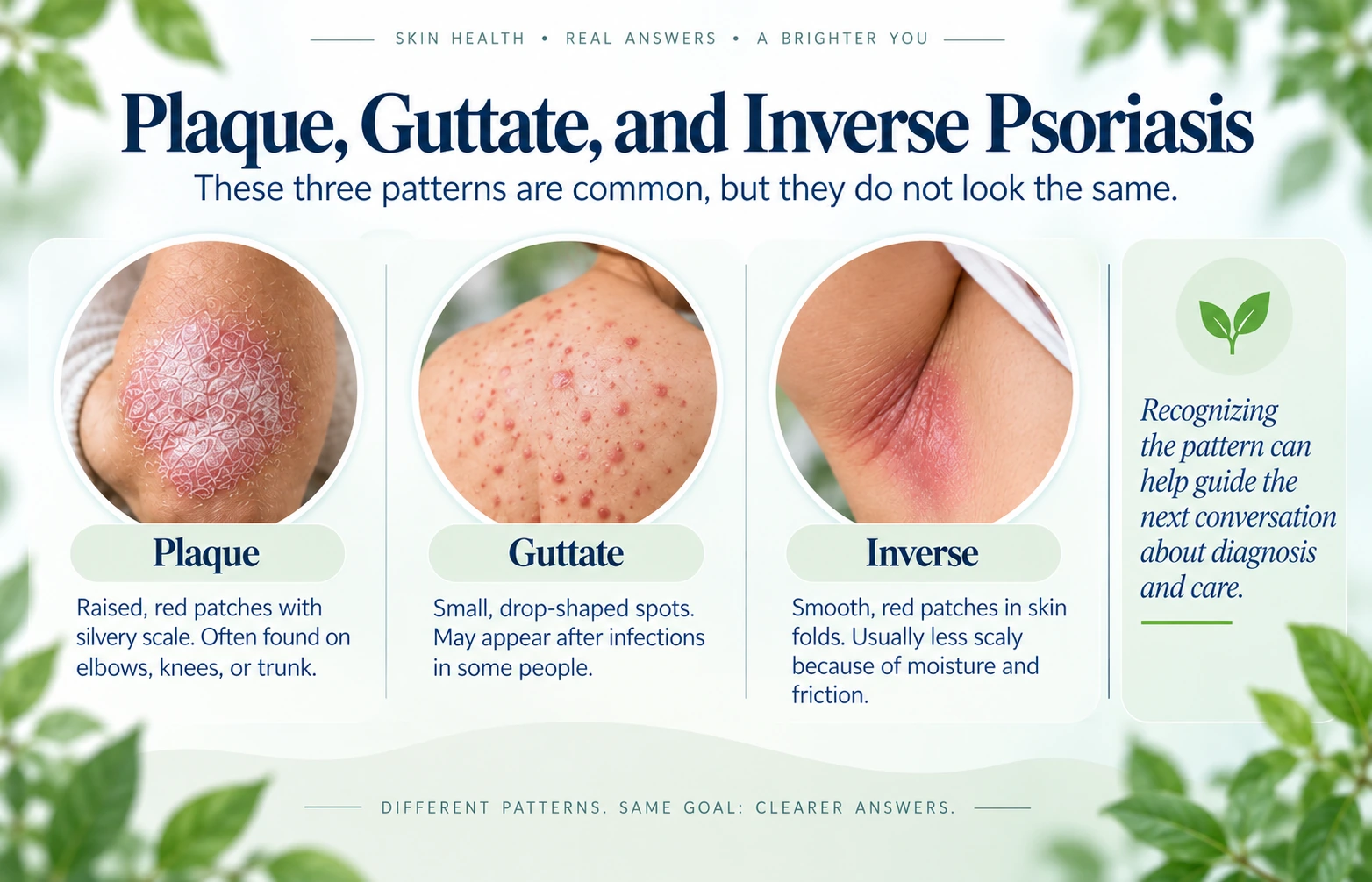 Visual concepts for plaque, guttate, and inverse psoriasis patterns